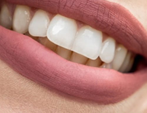Estetica dentale