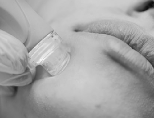 Biorevitalizzazione