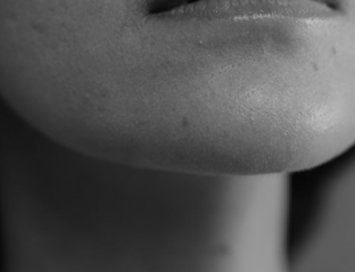Filler contorno mandibolare
