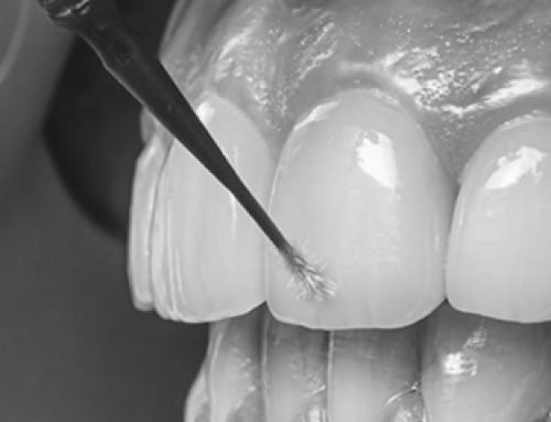 Igiene dentale